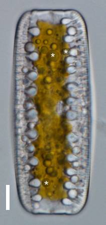 An image under the microscope of Epithemia with cynaobcterial endosymbionts designed in photo using asterisks.